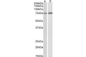 ABIN4902600 (0. (CYP2B6 Antikörper)