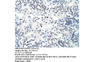 Rabbit Anti-HNRPH3 Antibody  Paraffin Embedded Tissue: Human Kidney Cellular Data: Epithelial cells of renal tubule Antibody Concentration: 4. (HNRNPH3 Antikörper  (N-Term))