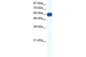 Western Blotting (WB) image for anti-Solute Carrier Family 18 (Vesicular Monoamine Transporter), Member 1 (SLC18A1) antibody (ABIN2461184) (SLC18A1 Antikörper)