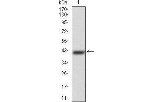 ERCC1 Antikörper  (AA 151-297)