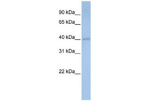 PDSS1 antibody used at 1 ug/ml to detect target protein. (PDSS1 Antikörper)