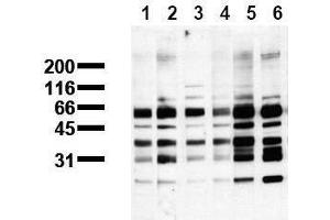 Western Blotting (WB) image for anti-Phosphoserine antibody (ABIN126866) (Phosphoserine Antikörper)