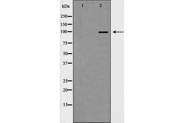 HDAC7 Antikörper  (C-Term)