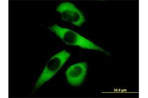 Immunofluorescence of purified MaxPab antibody to MARS on HeLa cell. (Mars (MARS) (AA 1-900) Antikörper)