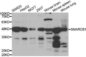 Western blot analysis of extracts of various cell lines, using SMARCB1 antibody (ABIN5973389) at 1/1000 dilution. (SMARCB1 Antikörper)