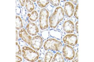 Immunohistochemistry of paraffin-embedded rat kidney using TST Rabbit pAb  at dilution of 1:200 (40x lens). (TST Antikörper  (AA 1-297))