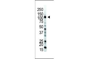 The anti-UBE1 Pab (ABIN388844 and ABIN2839150) is used in Western blot to detect UBE1 in HL-60 cell lysate. (E1 Ubiquitin (AA 1026-1058), (C-Term) Antikörper)