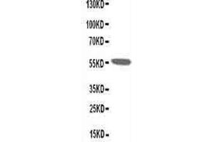 Anti-Nicotinic Acetylcholine Receptor alpha 1 antibody, Western blotting WB: Rat Skeletal Muscle Tissue Lysate (CHRNA1 Antikörper  (N-Term))