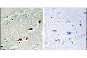 Immunohistochemistry analysis of paraffin-embedded human brain tissue, using NF-kappaB p65 (Ab-529) Antibody. (NF-kB p65 Antikörper  (AA 496-545))