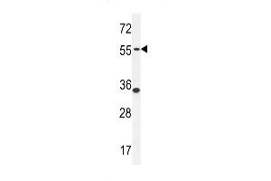 Western blot analysis in MDA-MB231 cell line lysates (35ug/lane). (PDE12 Antikörper  (C-Term))