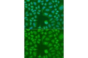 Immunofluorescence analysis of A549 cells using AES antibody. (AES Antikörper)