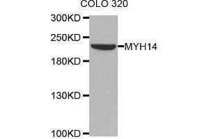 Western blot analysis of extracts of COLO320 cell line, using MYH14 antibody. (Myosin Antikörper)