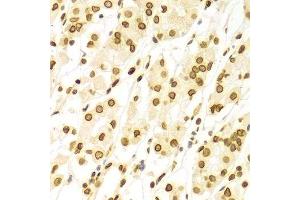 Immunohistochemistry (Paraffin-embedded Sections) (IHC (p)) image for anti-Lamin A/C (LMNA) (AA 403-572) antibody (ABIN3020785)