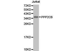 Western Blotting (WB) image for anti-Protein Phosphatase 2, Catalytic Subunit, beta Isozyme (PPP2CB) antibody (ABIN1874224) (PPP2CB Antikörper)