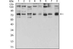 Western blot analysis using GFPT1 mouse mAb against Hela (1), HepG2 (2), HEK293 (3), BEL-7402 (4), SMMC-7721 (5), SK-MES-1 (6), C6 (7), and COS7 (8) cell lysate. (GFPT1 Antikörper  (AA 536-681))