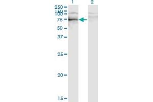 Western Blotting (WB) image for anti-SRY (Sex Determining Region Y)-Box 9 (SOX9) (AA 400-509) antibody (ABIN520382)