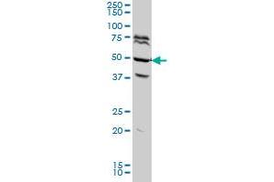 FOXA2 monoclonal antibody (M04A), clone 7G10 Western Blot analysis of FOXA2 expression in HeLa . (FOXA2 Antikörper  (AA 363-457))