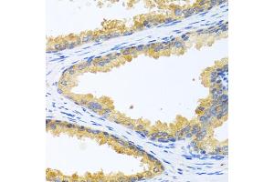 Immunohistochemistry of paraffin-embedded human prostate using KLK11 antibody. (Kallikrein 11 Antikörper)