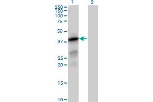 Western Blot analysis of PTPLAD1 expression in transfected 293T cell line by PTPLAD1 MaxPab polyclonal antibody. (PTPLAD1 Antikörper  (AA 1-362))