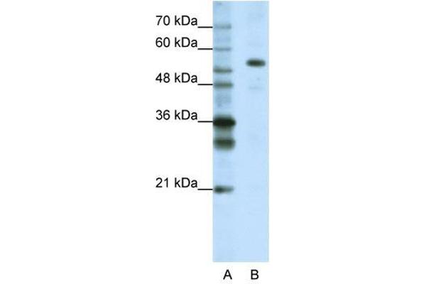 CPSF7 Antikörper  (C-Term)