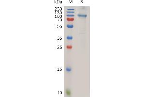 Human A Protein, hFc Tag on SDS-PAGE under reducing condition. (ADAM15 Protein (AA 18-696) (Fc Tag))