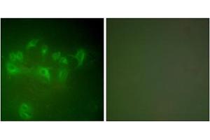 Immunofluorescence analysis of A549 cells, using MDM2 antibody (ABIN5976454). (MDM2 Antikörper  (C-Term))