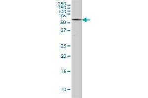 Western Blotting (WB) image for anti-Runt-Related Transcription Factor 2 (RUNX2) (AA 251-350) antibody (ABIN560185)