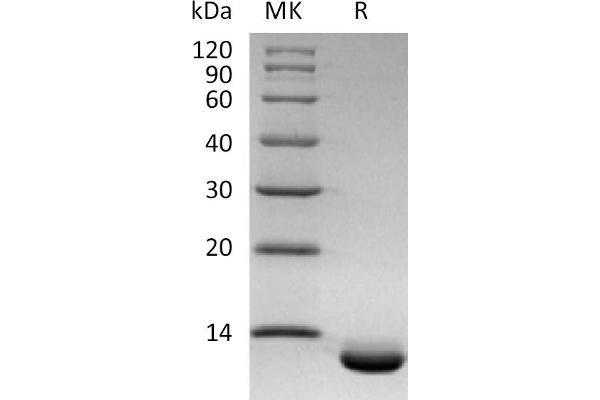 CXCL6 Protein (His tag)