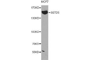 Western blot analysis of extracts of MCF-7 cells, using SETD5 antibody (ABIN5974406) at 1:300 dilution. (SETD5 Antikörper)