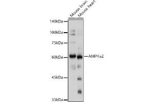 Western blot analysis of extracts of various cell lines, using AMPKα2 antibody (ABIN6129903, ABIN6146170, ABIN6146172 and ABIN6218273) at 1:1000 dilution. (PRKAA2 Antikörper  (AA 343-552))