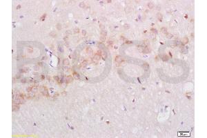 Immunohistochemistry (IHC) image for anti-Nerve Growth Factor Receptor (NGFR) (AA 301-400) antibody (ABIN725660)