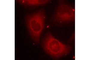 Immunofluorescence staining of methanol-fixed HeLa cells using Phospho-LIMK2-T505 antibody (ABIN2988124). (LIMK2 Antikörper  (pThr505))