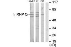 Western blot analysis of extracts from Jurkat/HuvEc/293 cells, using hnRNP Q Antibody. (SYNCRIP Antikörper  (AA 236-285))