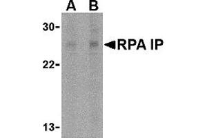 Western Blotting (WB) image for anti-RPA Interacting Protein (RPAIN) (C-Term) antibody (ABIN1030627) (RPAIN Antikörper  (C-Term))