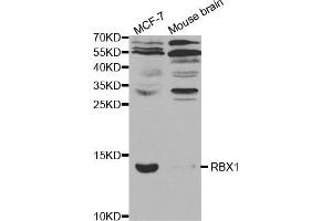 Western blot analysis of extracts of various cell lines, using RBX1 antibody (ABIN5970933) at 1/1000 dilution. (RBX1 Antikörper)