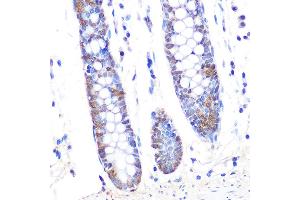 Immunohistochemistry of paraffin-embedded human colon using Thioredoxin 1 (Trx1/TXN) Rabbit mAb (ABIN1679926, ABIN3018425, ABIN3018426 and ABIN7101611) at dilution of 1:100 (40x lens). (TXN Antikörper)