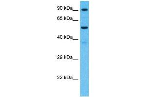 Host:  Rabbit  Target Name:  PCDHB7  Sample Type:  Fetal Kidney lysates  Antibody Dilution:  1. (PCDHb7 Antikörper  (Middle Region))