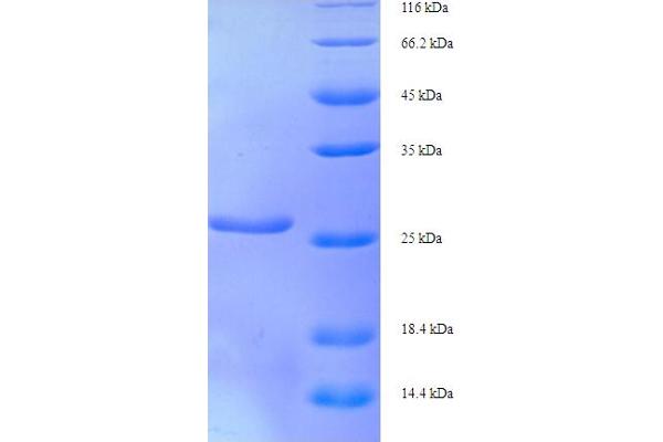 XRCC5 Protein (AA 251-455, partial) (His tag)