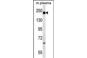 Western blot analysis in mouse plasma lysates (35ug/lane). (alpha 2 Macroglobulin Antikörper  (N-Term))