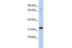 Image no. 1 for anti-Calcium Channel, Voltage-Dependent, beta 2 Subunit (CACNB2) (AA 21-70) antibody (ABIN6742718) (CACNB2 Antikörper  (AA 21-70))