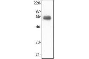 Western Blotting (WB) image for anti-Triggering Receptor Expressed On Myeloid Cells 1 (TREM1) antibody (ABIN2664607) (TREM1 Antikörper)