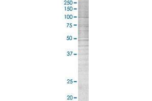 ABCD1 transfected lysate. (ABCD1 293T Cell Transient Overexpression Lysate(Denatured))