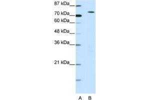 Western Blotting (WB) image for anti-MYST Histone Acetyltransferase 2 (MYST2) antibody (ABIN2460592) (MYST2 Antikörper)