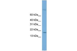WB Suggested Anti-CST8 Antibody Titration: 0. (CST8 Antikörper  (Middle Region))