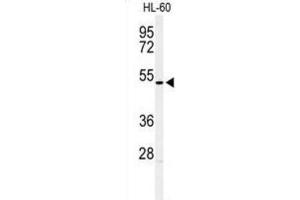 Western Blotting (WB) image for anti-Homeobox A3 (HOXA3) antibody (ABIN3004366) (HOXA3 Antikörper)