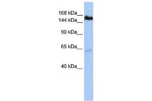 Western Blotting (WB) image for anti-Tankyrase, TRF1-Interacting Ankyrin-Related ADP-Ribose Polymerase (TNKS) antibody (ABIN2458044) (TNKS Antikörper)