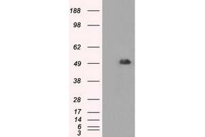 HEK293T cells were transfected with the pCMV6-ENTRY control (Left lane) or pCMV6-ENTRY CD4 (Right lane) cDNA for 48 hrs and lysed. (CD4 Antikörper)