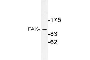 Western blot (WB) analyzes of FAK antibody in extracts from HT-29 cells. (FAK Antikörper)