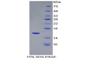 SDS-PAGE (SDS) image for Renin (REN) ELISA Kit (ABIN6574235)