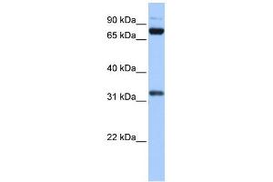 WB Suggested Anti-TAF6 Antibody Titration:  0. (TAF6 Antikörper  (C-Term))